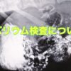 Thumbnail of related posts 116